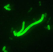 Yersinia pestis fluorescent.jpeg