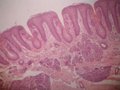 الحليمات الورقية Foliate papillae