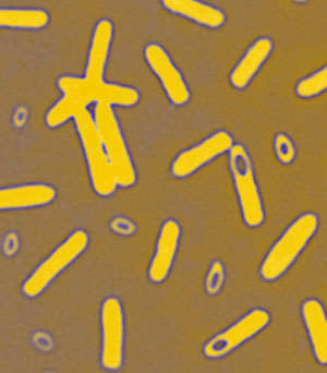 070523 botulinum 300.jpg