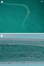 ملف:Thelazia callipaeda female.gif