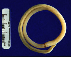 Ascaris lumbricoides.jpeg