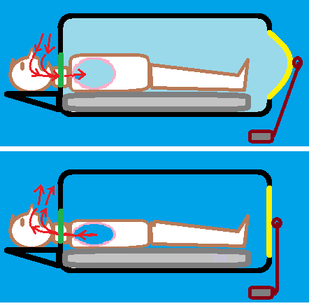 ملف:Iron lung action diagrams.png