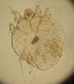 Sarcoptes scabei 2.jpg