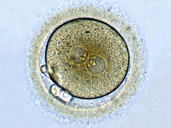 Zygote1.jpg