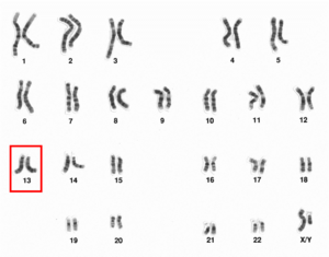 Human male karyotpe high resolution - Chromosome 13.png