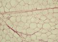 White adipose tissue in paraffin section