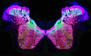 النخاع الشوكي