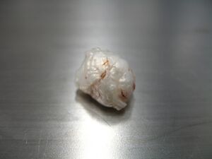 المظهر العياني لكيسى داخل الجمجمة تم استئصالها (جراحيًا)، بمظهر لؤلؤي.