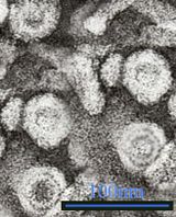 Hepatitis B virus 1.jpg