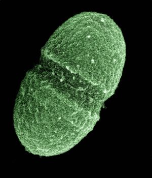 Enterococcus faecalis20023-300.jpg