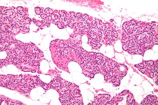 Intermediate magnification micrograph. H&E stain. The white round structures are fat cells. Adipose tissue comprises 25–40% of normal parathyroid gland tissue.[7]