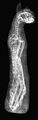 Radiograhy. The cat died as an adult at approximately twenty-two months of age.[18]