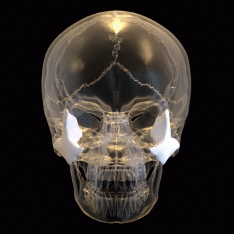 Zygomatic bone - animation 02.gif