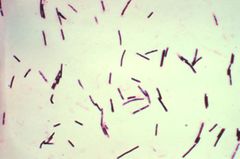 Clostridium perfringens.jpg