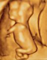 3D ultrasound of 3-بوصة (76 mm) fetus (about 14 weeks gestational age)