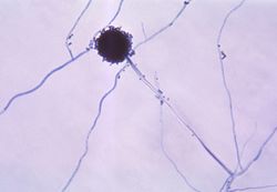 Aspergillus niger 01.jpg