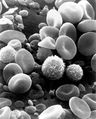 SEM image of normal circulating human blood.