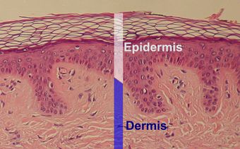 Epidermis-delimited.JPG