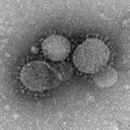 MERS-CoV electron micrograph1.jpg