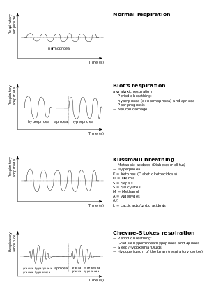 Breathing abnormalities.svg