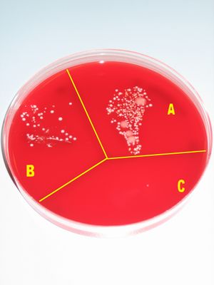A Petri dish containing a red growth medium, and subdivided into three sectors, labeled A, B and C, respectively. There is much visible microbial growth in culture A, some growth in culture B, and virtually no growth in culture C.