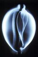 X-ray image of Cypraea