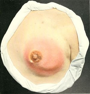 Atlas of clinical surgery; with special reference to diagnosis and treatment for practitioners and students (1908) (14768289625).jpg