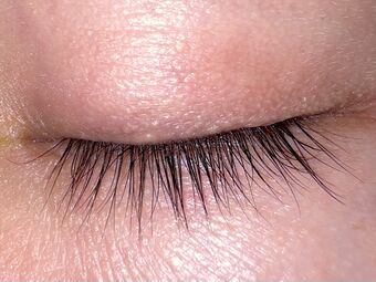 Closed human eye, superior view.jpg