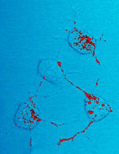 Photomicrograph of mouse neurons showing red stained inclusions identified as scrapies prion protein.