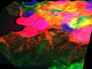 الشعيرات الدموية