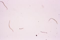 Onchocerca volvulus 01.jpg