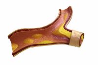 High-density lipoprotein1.jpg