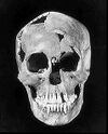 Mnwomanskull.jpg