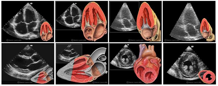 Heart normal tte views.jpg