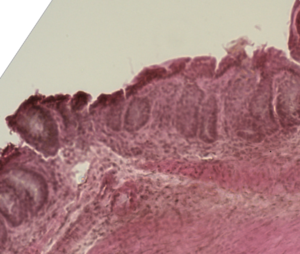 Mouse colon histology of acute graft versus host disease.png
