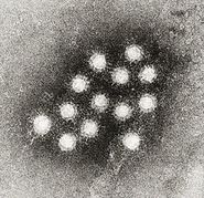 Hepatitis A virus 02.jpg
