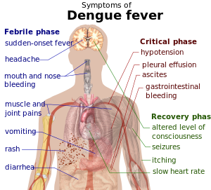 Outline of a human torso with arrows indicating the organs affected in the various stages of dengue fever