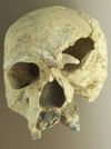 Steinheimer Urmensch Schaedel.jpg